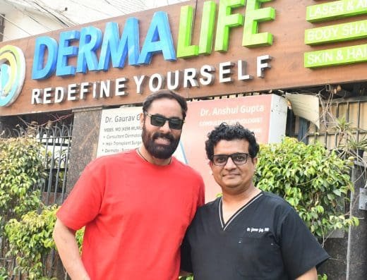 Hair Transplant in Delhi: Side Effects You Should Know