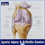 Sports Injury and Arthritis Centre