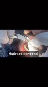 Pearls Advanced Dental Care