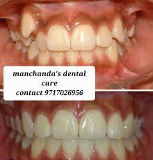 Manchanda’s Dental & Hair Transplant