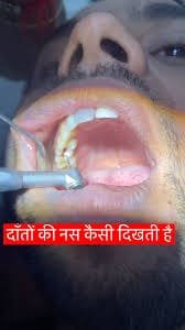 Pearls Advanced Dental Care